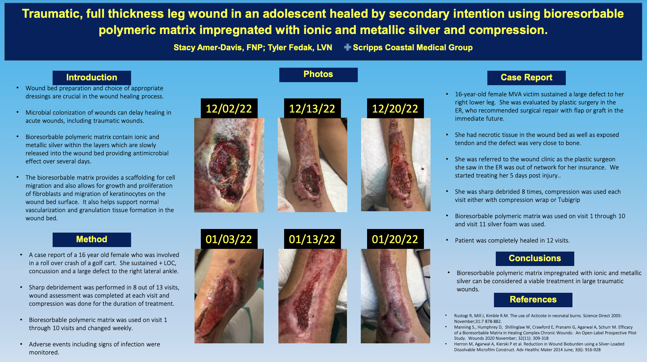 SAWC FALL 2023 Poster: Traumatic, full thickness leg wound in an adolescent healed by secondary intention using bioresorbable polymeric matric impregnated with ionic and metallic silver and compression. 