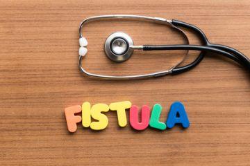 fistula management