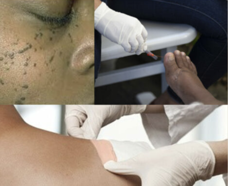 Skin of Color: Dermatological Features