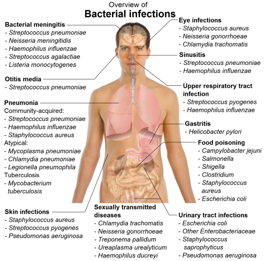what is antibacterial infection