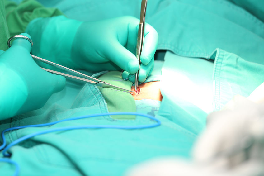 Preventing Post-operative Complications