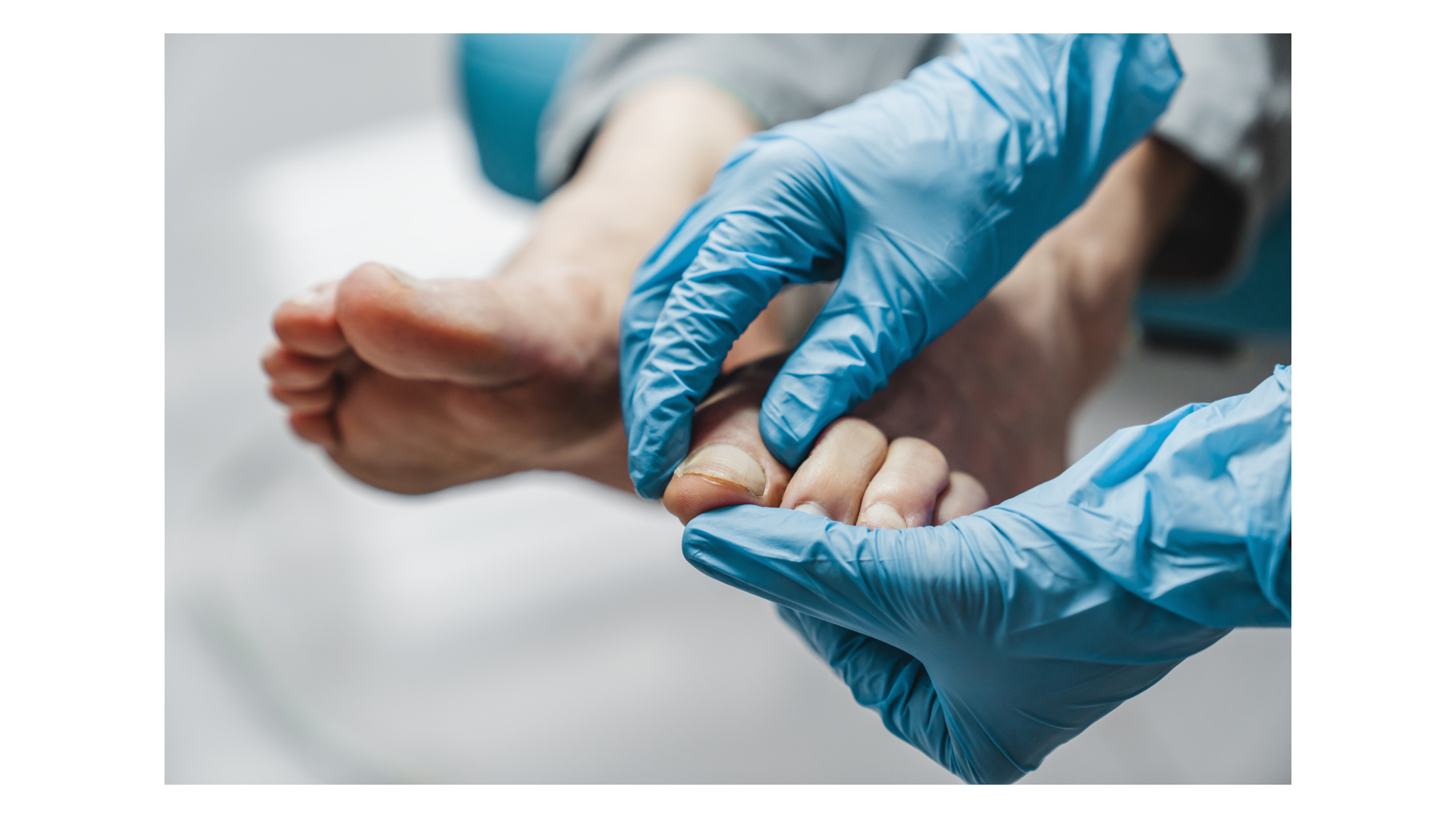 Healthcare with gloves examining patient's foot