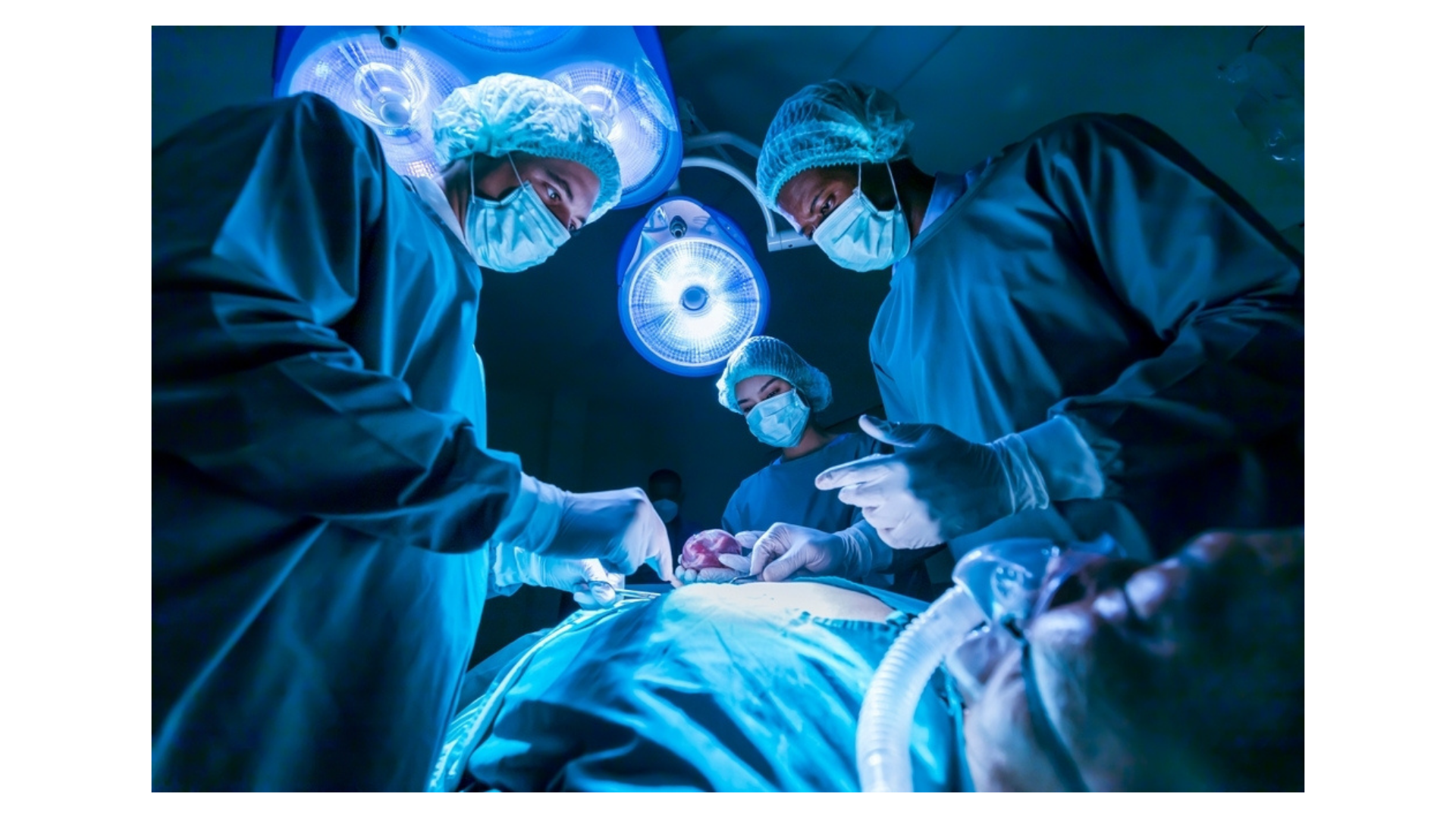 Surgeons around a patient in the OR