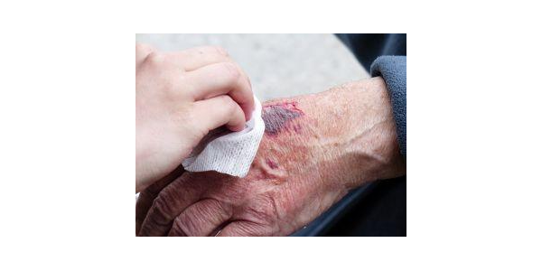 5 Reasons Why Wounds Won't Heal | Assessing Non-Healing Wounds
