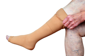 Compression Therapy: Indications, Types, and Application