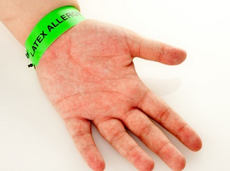 Contact Dermatitis