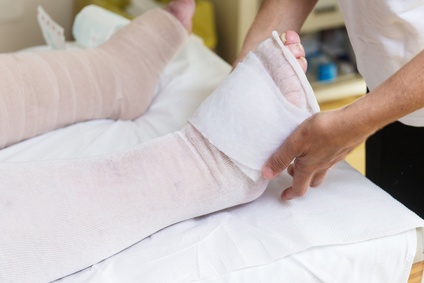 Compression Therapy: Indications, Types, and Application Compression Therapy  in Wound Care: Indications, Types, and Application