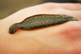 Scabies, Medicinal and Wild Maggots, and Medicinal and Wild Leeches:  Parasites in Wound Care