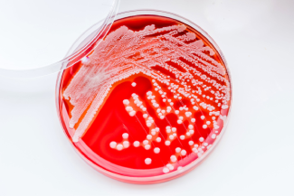 Infection