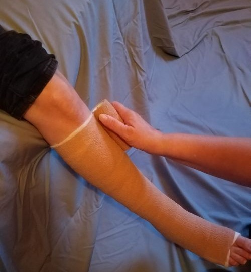 The Rap On Wrapping 10 Tips For Effectively Bandaging A Wound Woundsource