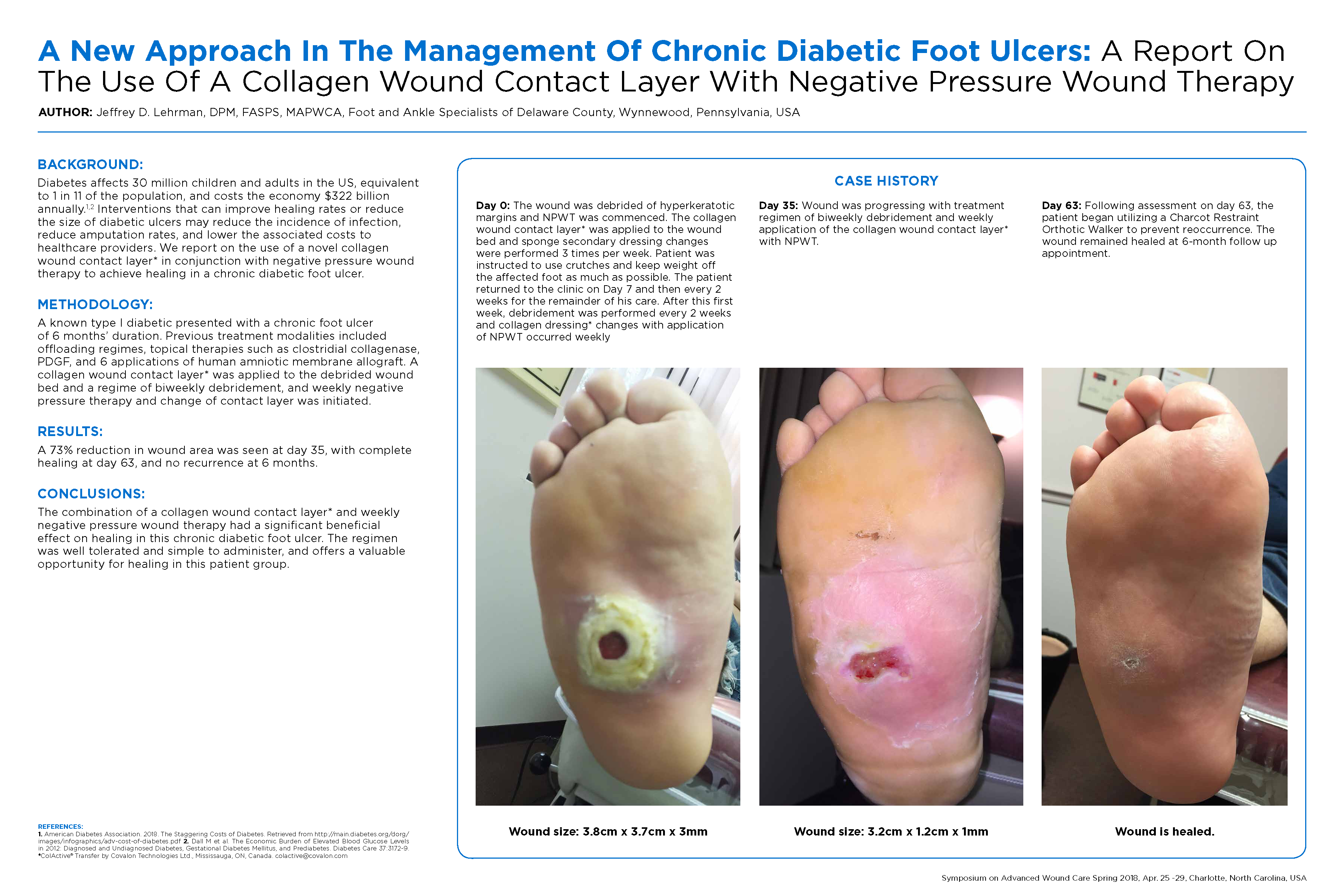 literature review on the management of diabetic foot ulcer