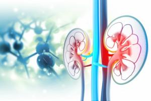 calciphylaxis patient education