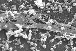 Staphylococcus aureus biofilm