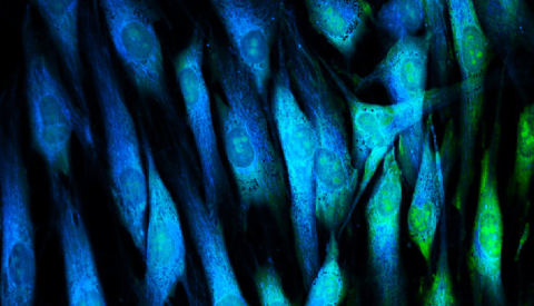 Tubulin cells in fibroblasts